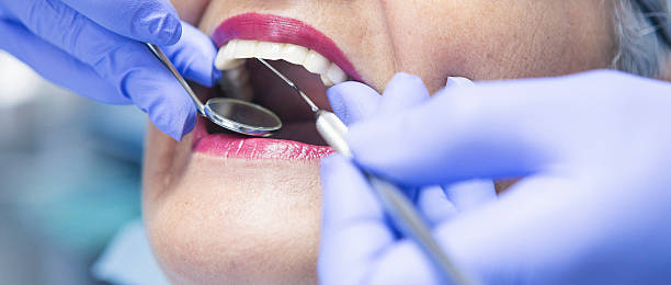 Best Emergency Treatment for Dental Infections or Abscesses in Burns Harbor, IN